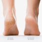 Icensia Silk Pro